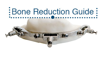 2_Bone_Reduction_Guide