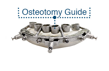 3_Osteotomy_Guide