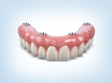 SK_Dental_Hybrid_Denture