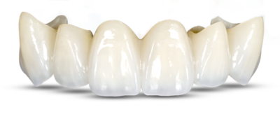 crown-and-bridge-solutions-1