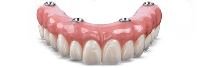 crown-and-bridge-solutions-1