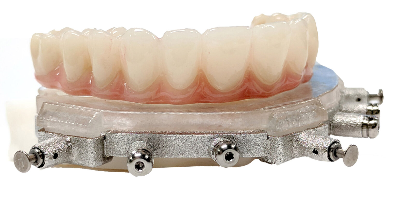 AllonX SK Dental Lab