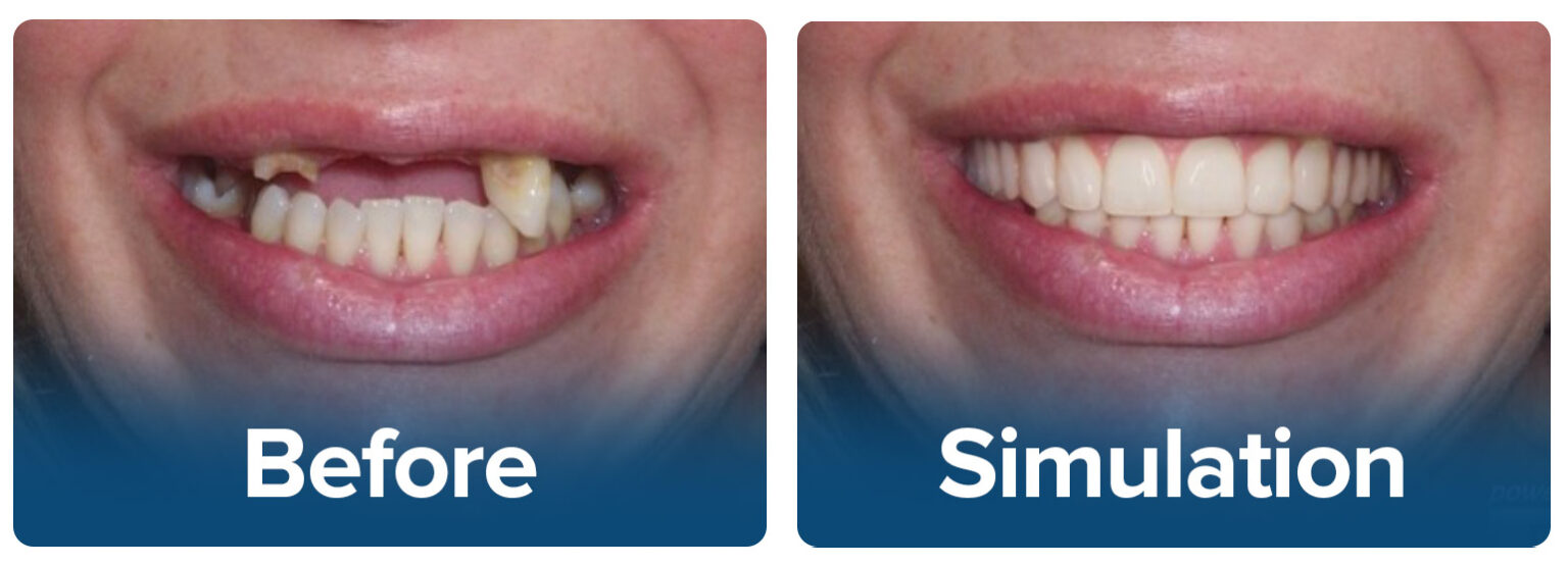 AllonX SK Dental Lab