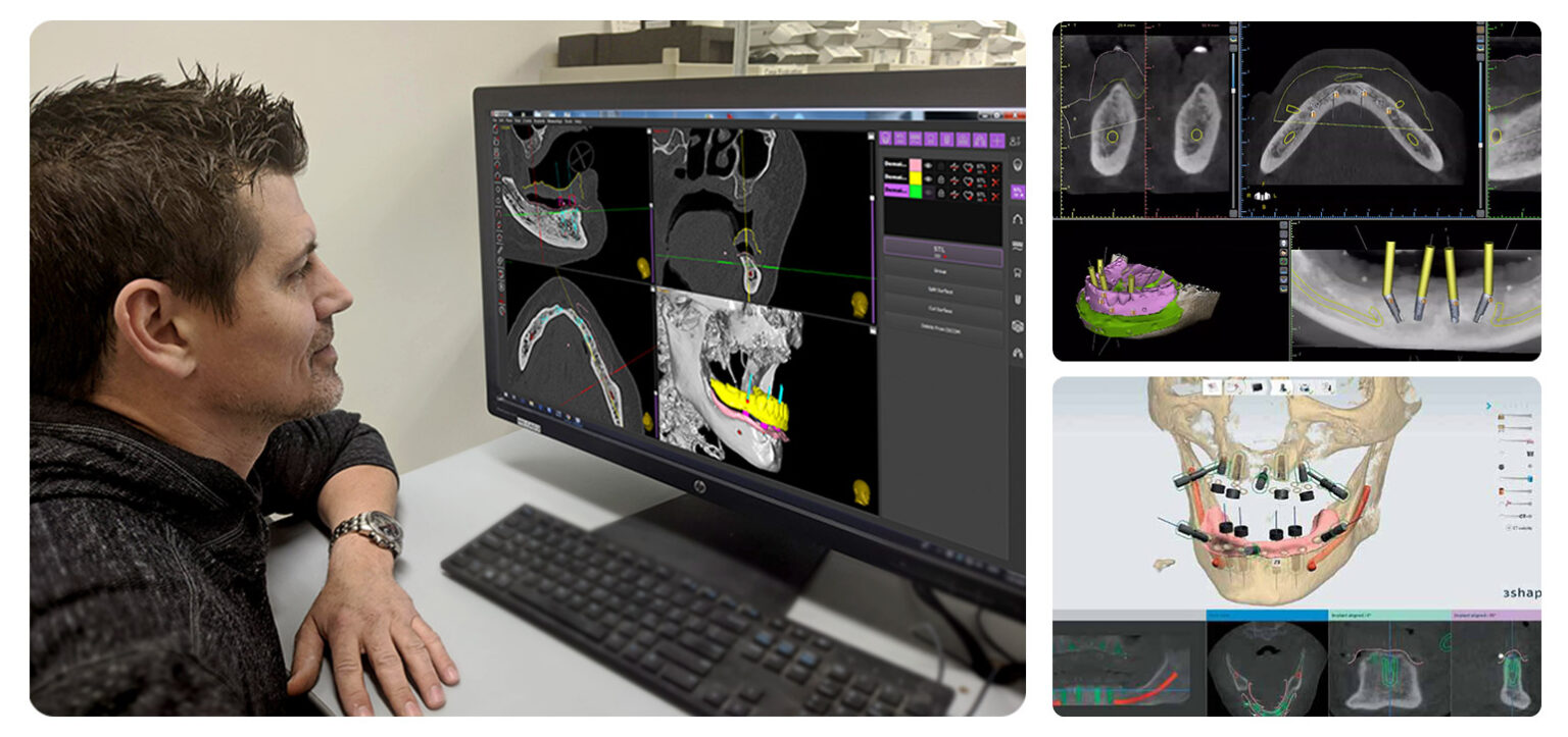 AllonX SK Dental Lab